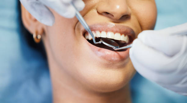 Best Holiday Emergency Dentist in Tunkhannock, PA