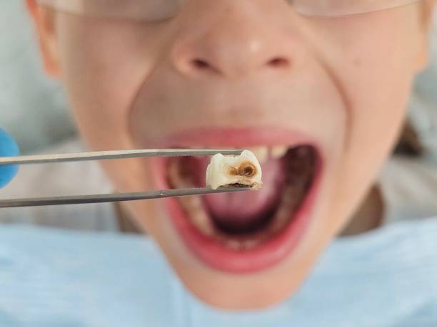 Best Pediatric Emergency Dentist in Tunkhannock, PA
